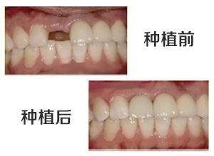 最新牙齿修复技术揭秘，小巷中的隐秘宝藏牙科诊所